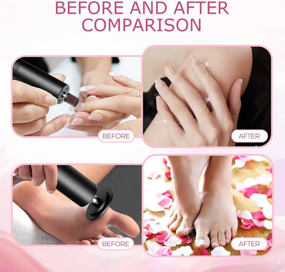 SilkFeet Foot Sander